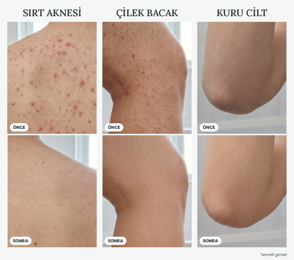Peeling Etkili Hızlı Kuruyan Duş Lifi