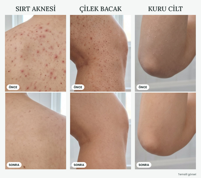 Peeling Etkili Hızlı Kuruyan Duş Lifi